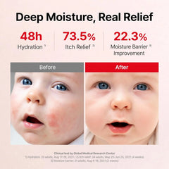 ATOPALM MLE Eczema Cream, 5.6 fl oz (160ml)