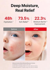 ATOPALM MLE Eczema Cream 2-Pack, 2.2 fl oz x 2ea (65ml x 2ea)